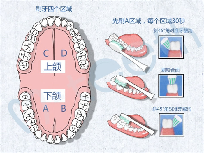 口腔清潔